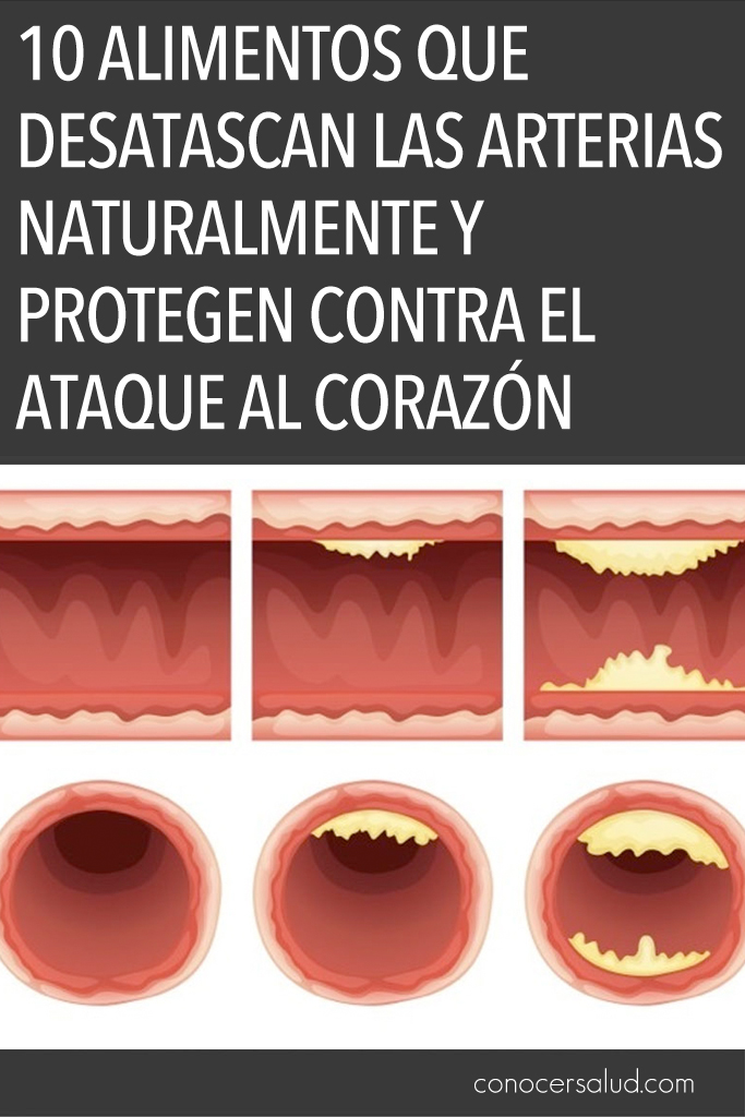 10 alimentos que desatascan las arterias naturalmente y protegen contra el ataque al corazón