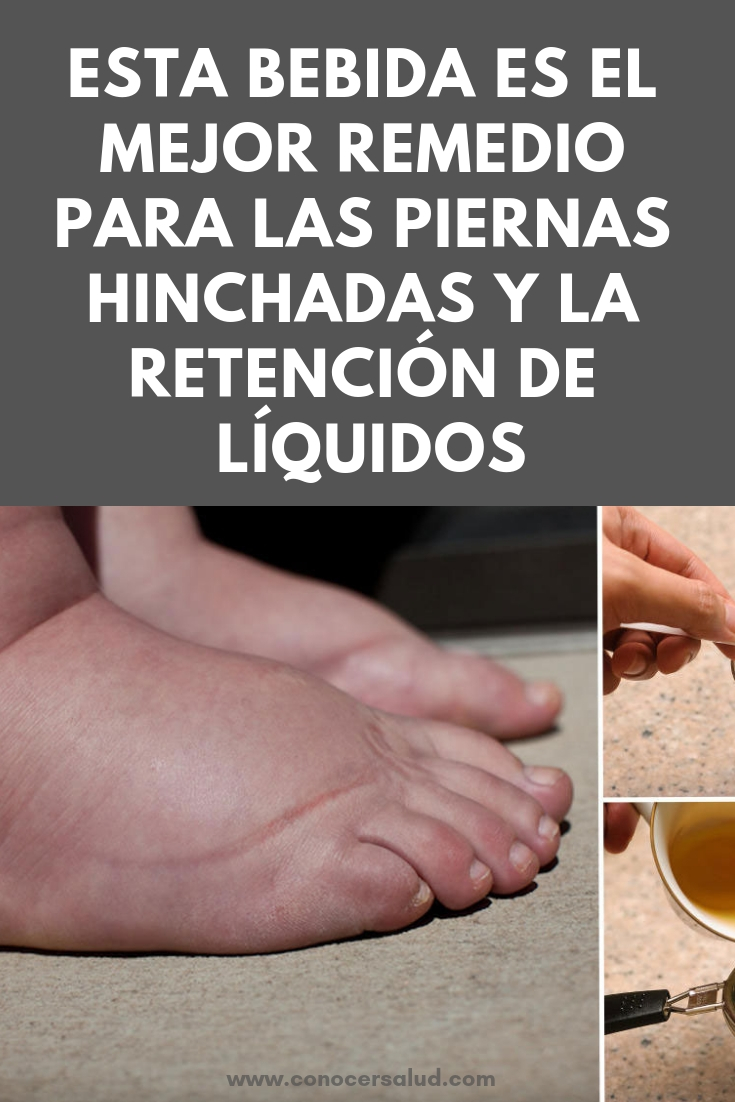 Esta bebida es el mejor remedio para las piernas hinchadas y la retención de líquidos