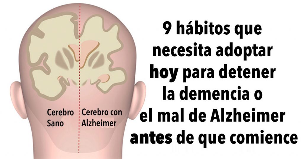9 hábitos que necesita adoptar hoy para detener la demencia o el mal de Alzheimer antes de que comience