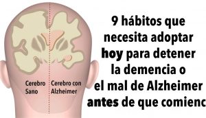 9 hábitos que necesita adoptar hoy para detener la demencia o el mal de Alzheimer antes de que comience