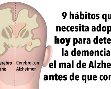 9 hábitos que necesita adoptar hoy para detener la demencia o el mal de Alzheimer antes de que comience