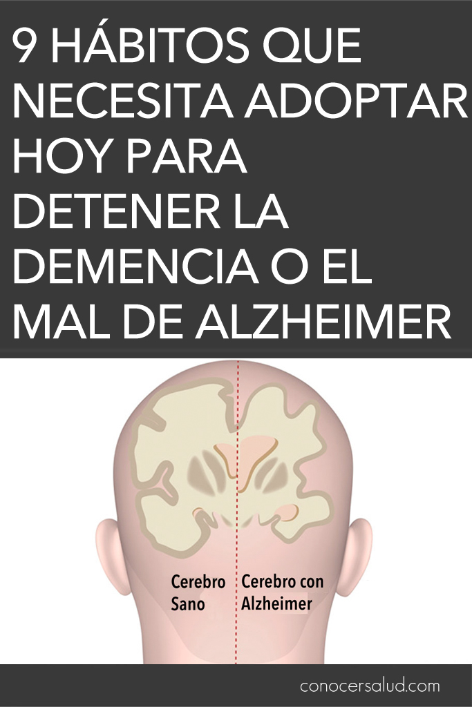 9 hábitos que necesita adoptar hoy para detener la demencia o el mal de Alzheimer antes de que comience