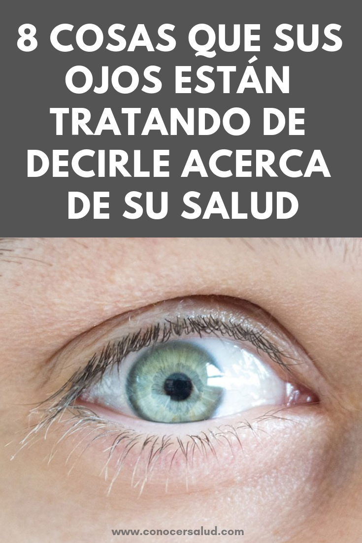 8 cosas que sus ojos están tratando de decirle acerca de su salud