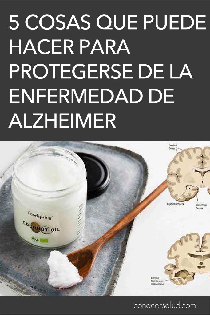 5 cosas que puede hacer para protegerse de la enfermedad de Alzheimer