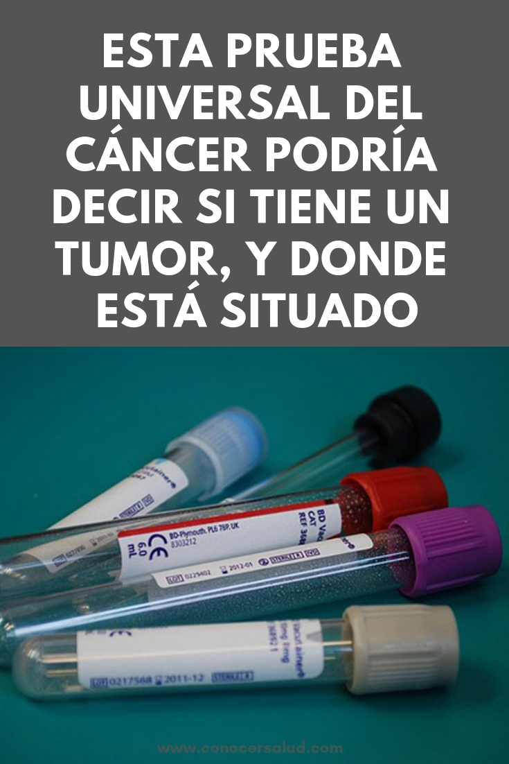 Esta prueba universal del cáncer podría decir si tiene un tumor, y donde está situado