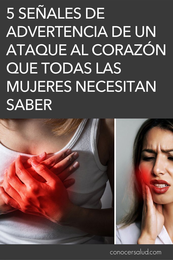 5 señales de advertencia de un ataque al corazón que todas las mujeres necesitan saber