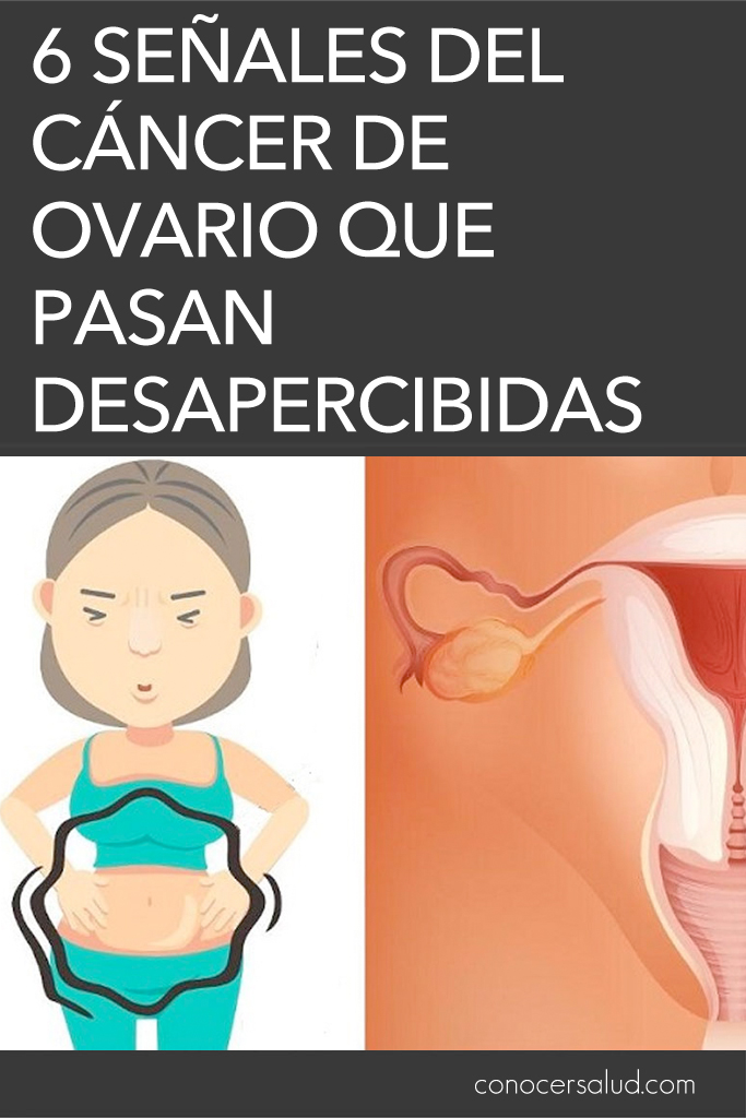 6 señales del cáncer de ovario que comúnmente pasan desapercibidas: el asesino silencioso