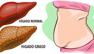 6 señales claras de advertencia de que su hígado está lleno de toxinas y está generando grasa