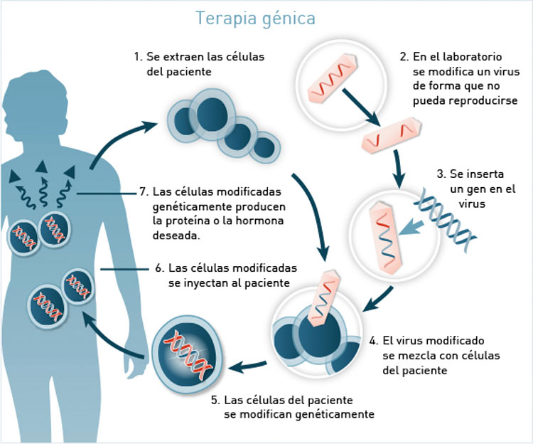 Casi el 40% de los pacientes con cáncer están en remisión después de un solo tratamiento de esta terapia génica