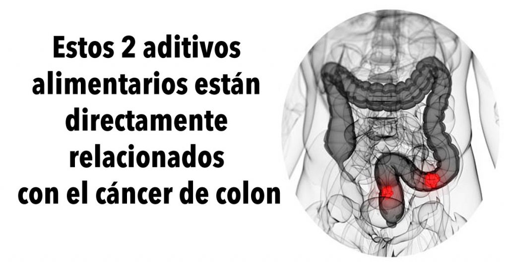 Estos 2 aditivos alimentarios están directamente relacionados con el cáncer de colon, según una investigación