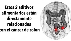 Estos 2 aditivos alimentarios están directamente relacionados con el cáncer de colon, según una investigación