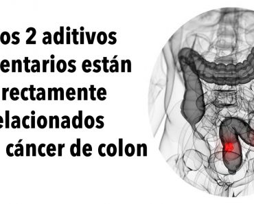 Estos 2 aditivos alimentarios están directamente relacionados con el cáncer de colon, según una investigación