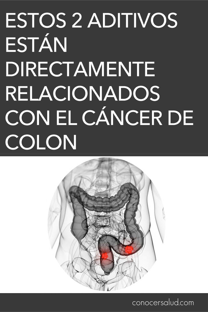 Estos 2 aditivos alimentarios están directamente relacionados con el cáncer de colon, según una investigación