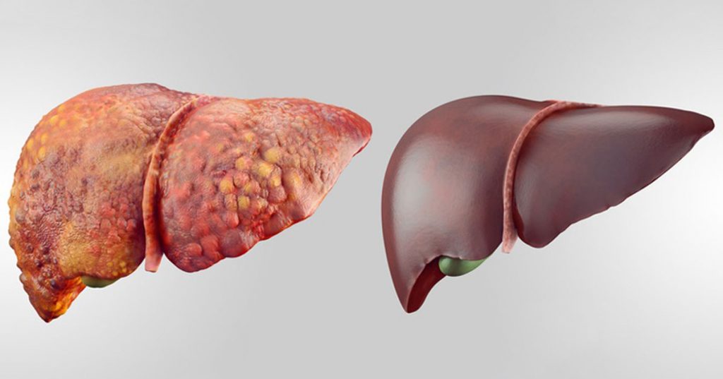 6 alimentos fundamentales que desintoxican su hígado rápidamente