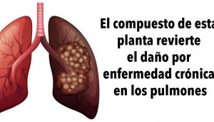 El compuesto de esta planta revierte el daño por enfermedad crónica en los pulmones, de acuerdo con una investigación