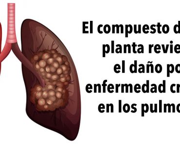 El compuesto de esta planta revierte el daño por enfermedad crónica en los pulmones, de acuerdo con una investigación