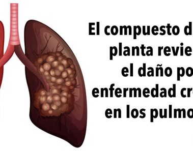 El compuesto de esta planta revierte el daño por enfermedad crónica en los pulmones, de acuerdo con una investigación