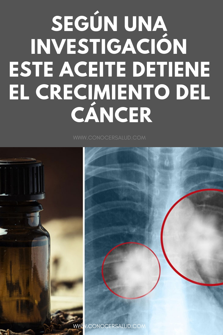 Según una investigación este aceite detiene el crecimiento del cáncer