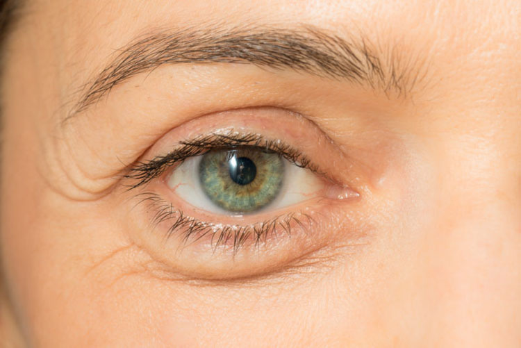 5 signos de deficiencia de vitaminas que puedes ver en tu cara