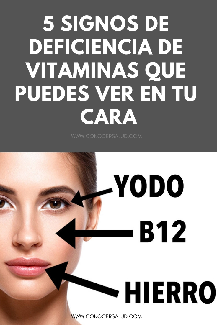 5 signos de deficiencia de vitaminas que puedes ver en tu cara