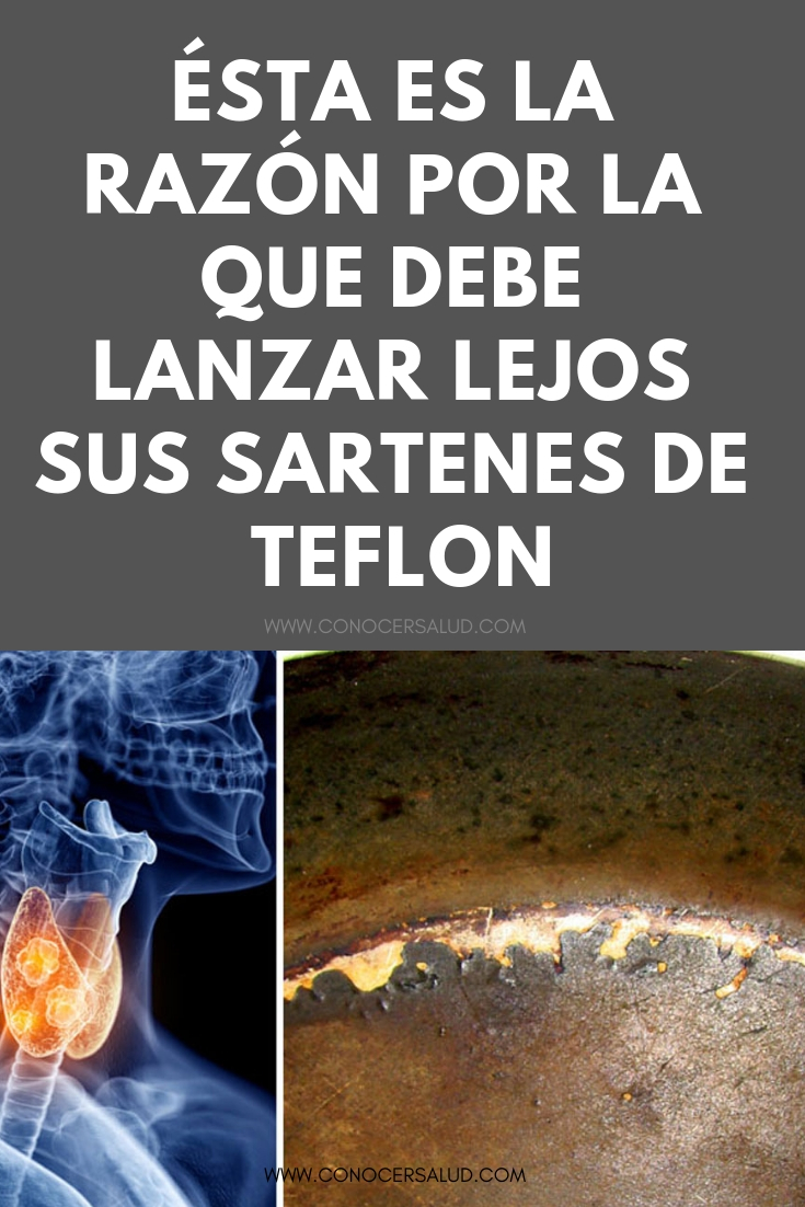 Ésta es la razón por la que debe lanzar lejos sus sartenes de Teflon