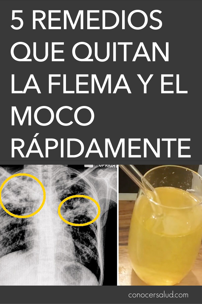 5 remedios que quitan la flema y el moco rápidamente