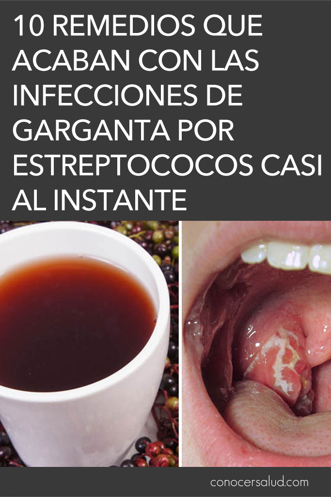 10 Remedios que acaban con las infecciones de garganta por estreptococos casi al instante