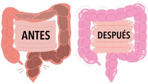 8 remedios naturales para limpiar su colon RÁPIDAMENTE