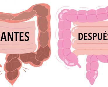 8 remedios naturales para limpiar su colon RÁPIDAMENTE