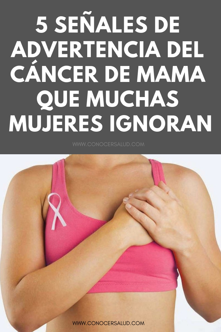 5 señales de advertencia del cáncer de mama que muchas mujeres ignoran