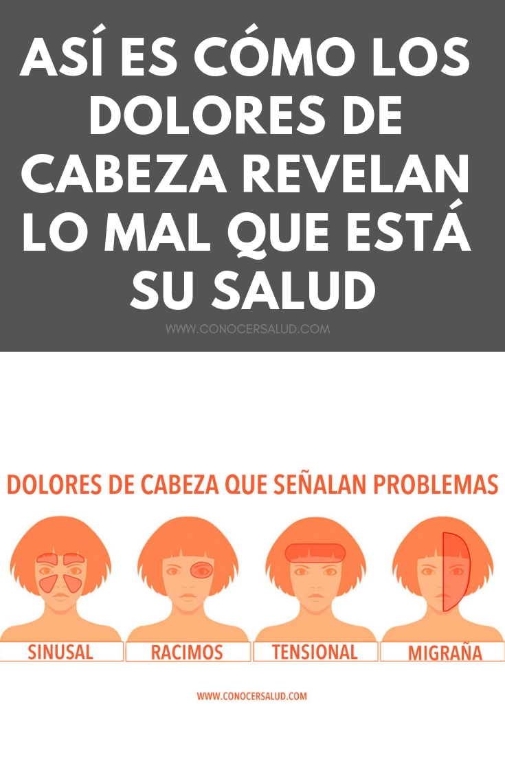 Así es cómo los dolores de cabeza revelan lo mal que está su salud