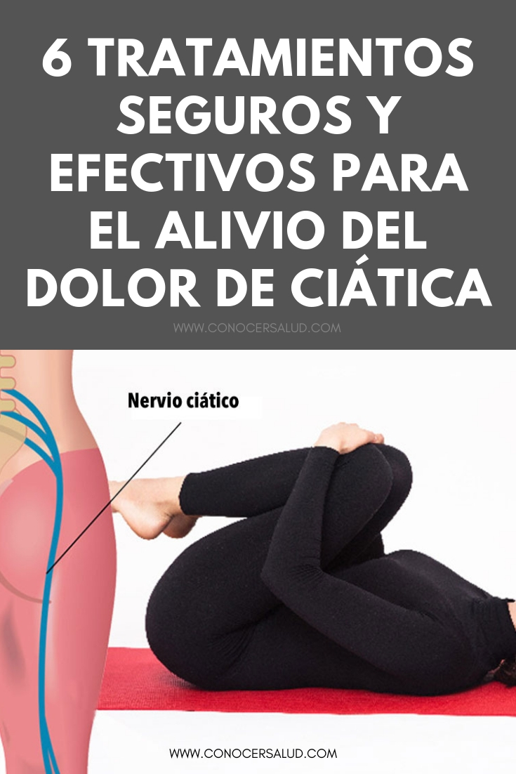 6 Tratamientos seguros y efectivos para el alivio del dolor de ciática