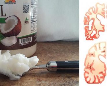 Este hombre tomaba 2 cucharadas de aceite de coco dos veces al día durante 60 días y esto le sucedió a su cerebro