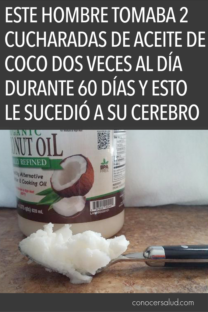 Este hombre tomaba 2 cucharadas de aceite de coco dos veces al día durante 60 días y esto le sucedió a su cerebro