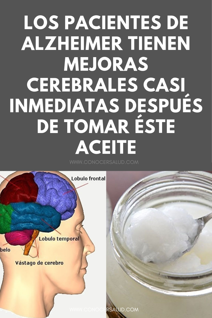 Los pacientes de Alzheimer tienen mejoras cerebrales casi inmediatas después de tomar éste aceite