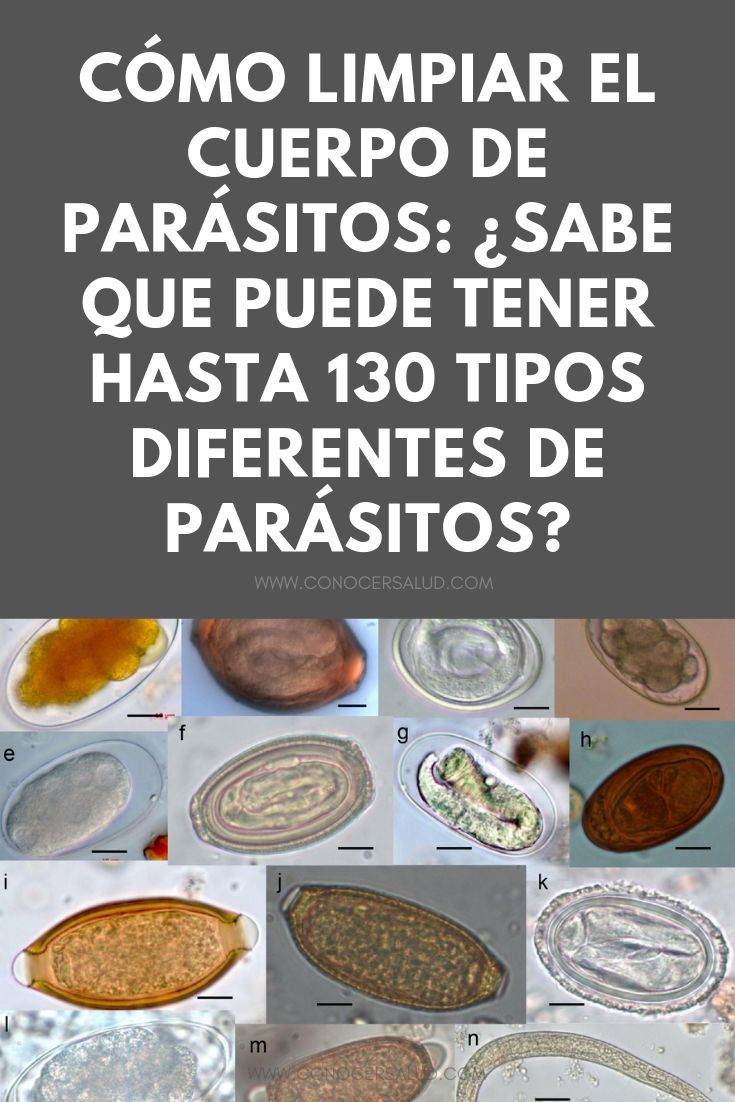 Cómo limpiar el cuerpo de parásitos: ¿sabe que puede tener hasta 130 tipos diferentes de parásitos?