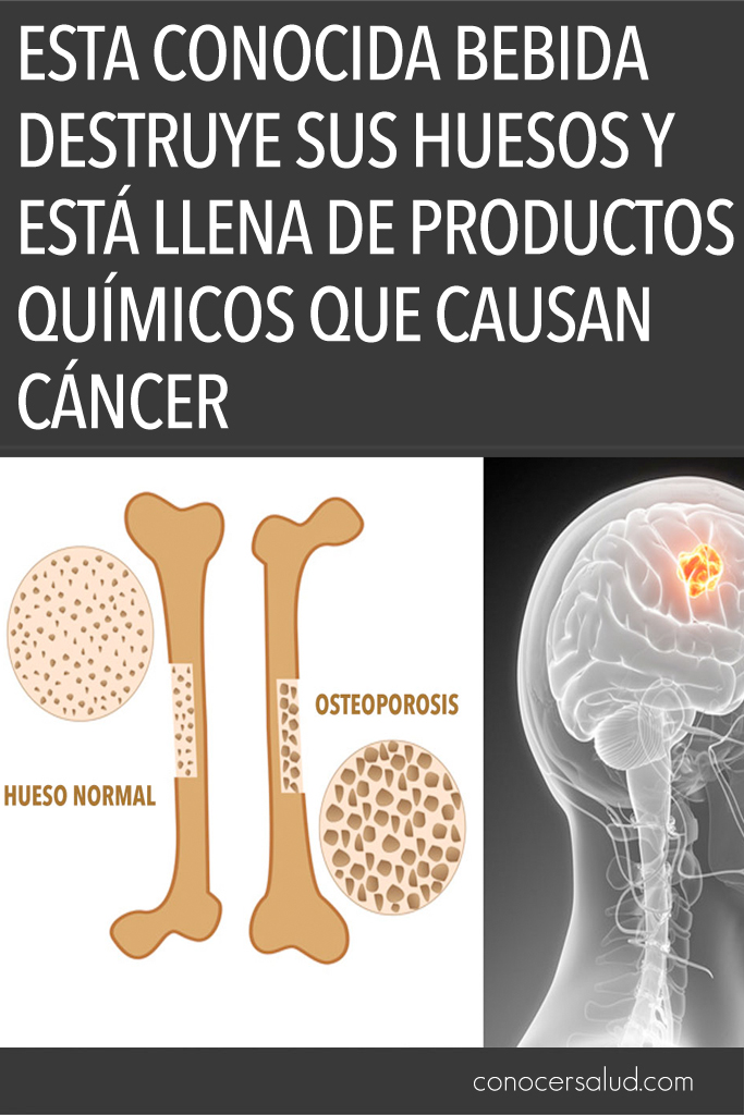 ESTA conocida bebida destruye sus huesos y está llena de productos químicos que causan cáncer