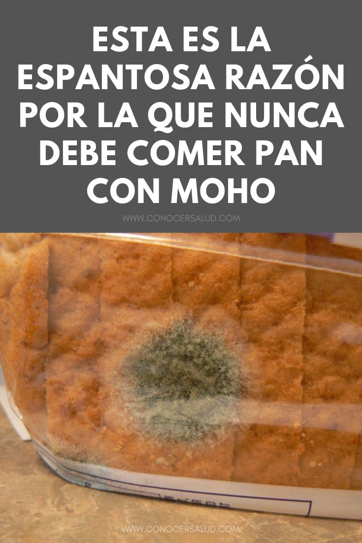 Esta es la espantosa razón por la que NUNCA debe comer pan con moho