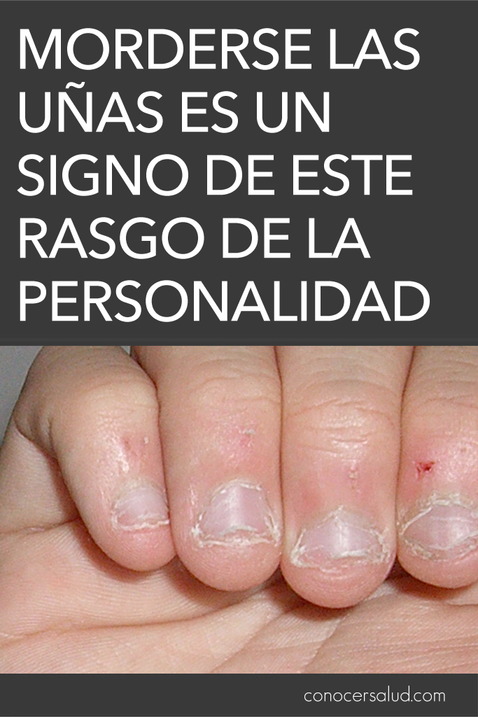 Morderse las uñas es un signo de ESTE rasgo de la personalidad