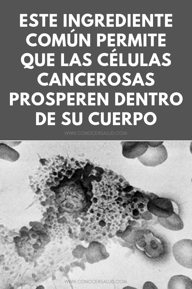 Este ingrediente común permite que las células cancerosas prosperen dentro de su cuerpo