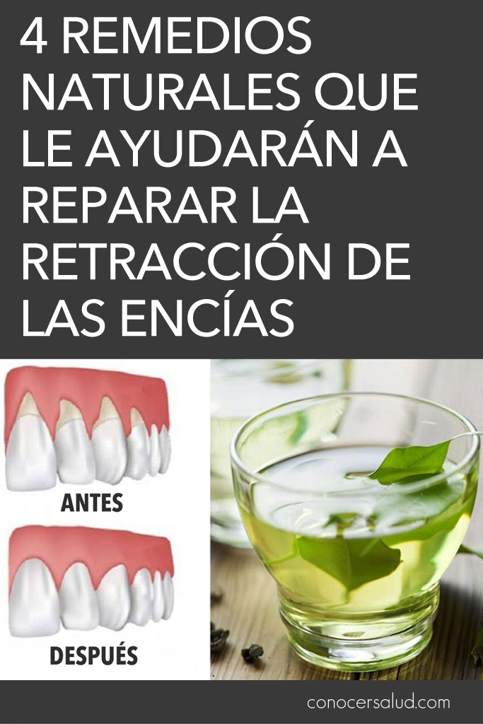 4 remedios naturales que le ayudarán a reparar la retracción de las encías