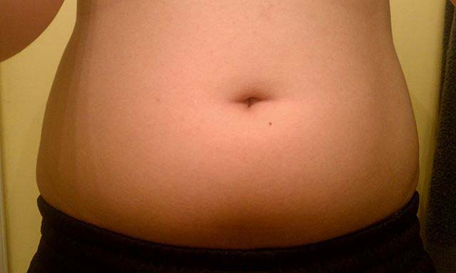 4 señales de que su cuerpo es demasiado ácido y cómo arreglarlo