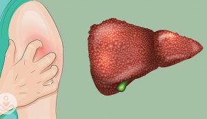 5 señales de que usted puede tener daño hepático sin siquiera saberlo