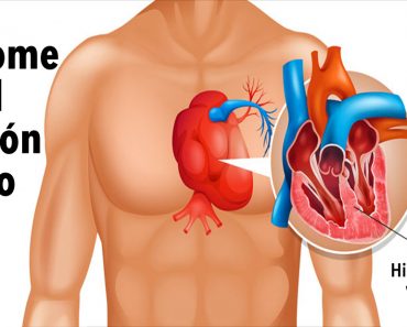 Síndrome del corazón roto: ¿Se puede morir de un corazón roto?