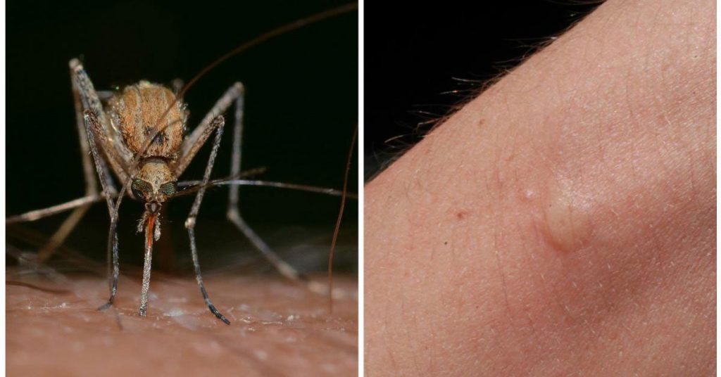 Si obtienes suficiente de esta vitamina todos los días, no te picarán los mosquitos este año