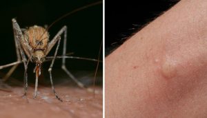 Si obtienes suficiente de esta vitamina todos los días, no te picarán los mosquitos este año