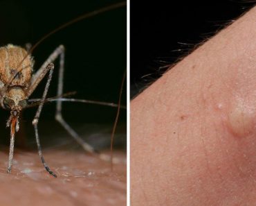 Si obtienes suficiente de esta vitamina todos los días, no te picarán los mosquitos este año