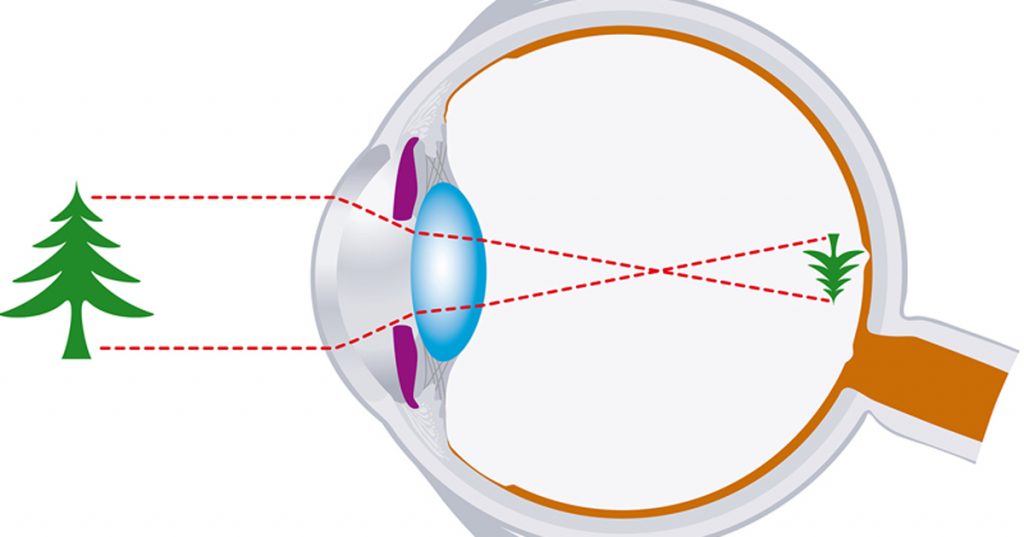 7 consejos para mejorar tu vista RÁPIDAMENTE. ¡Comienza YA!