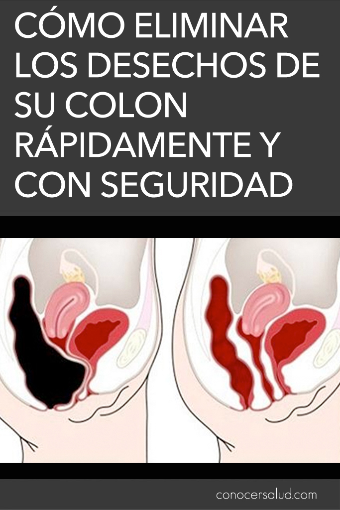 Cómo eliminar los desechos de su colon rápidamente y con seguridad