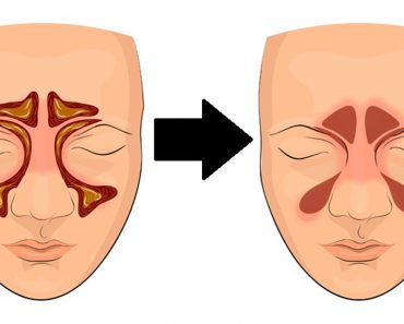 Cómo limpiar tus senos paranasales en 4 pasos con esta simple técnica